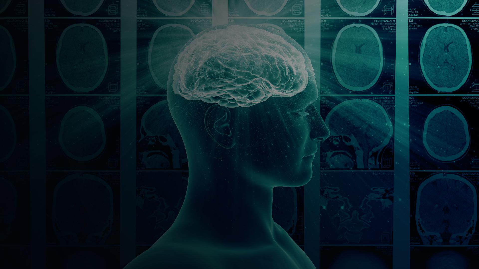 The Brain that Changes Itself