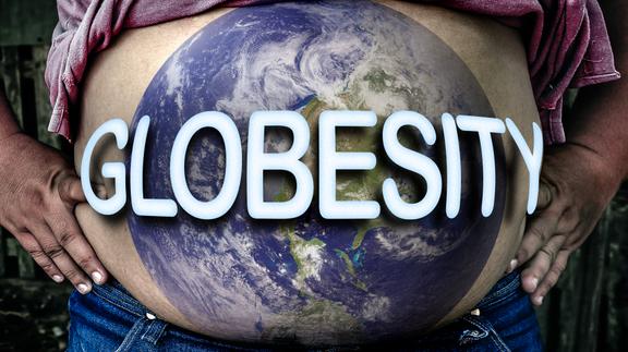 Globesity